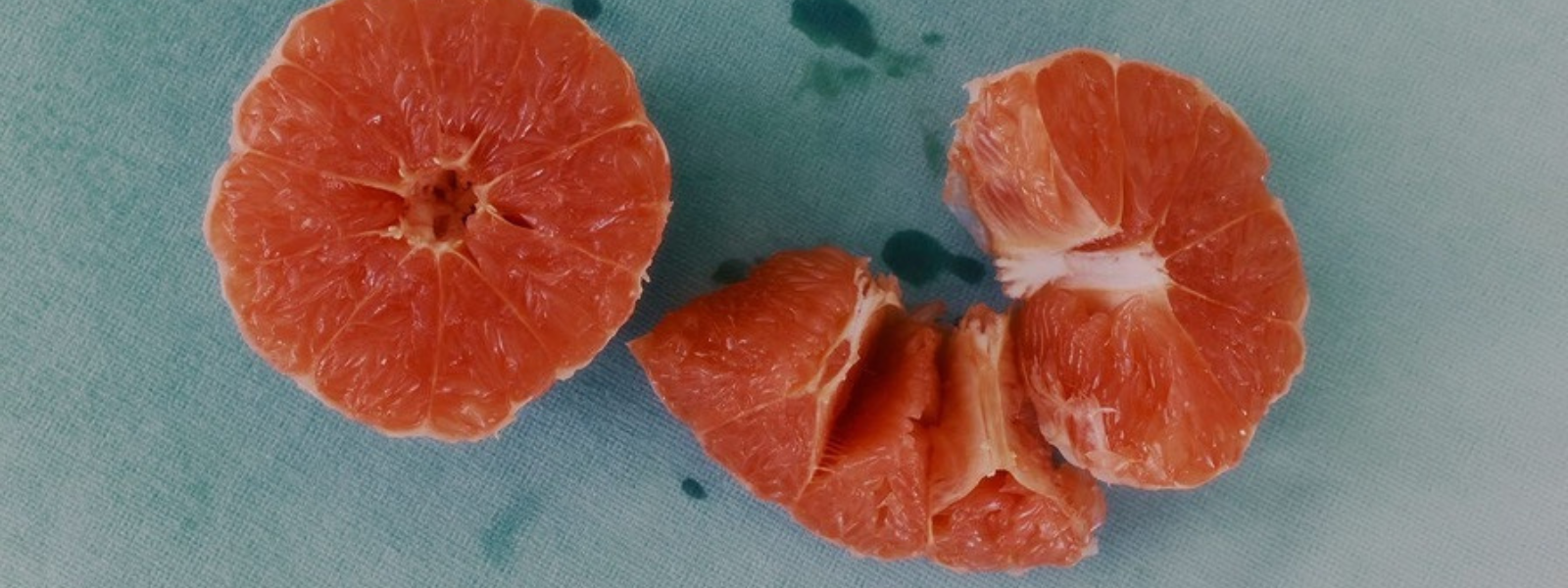 The Microbiome of Your Home